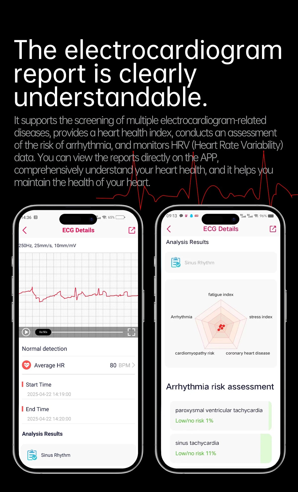 Nouveau ECG examen physique orgue santé Smartwatch hommes pression artérielle acide uricique graisse corporelle montres Bluetooth appel mme montre intelligente